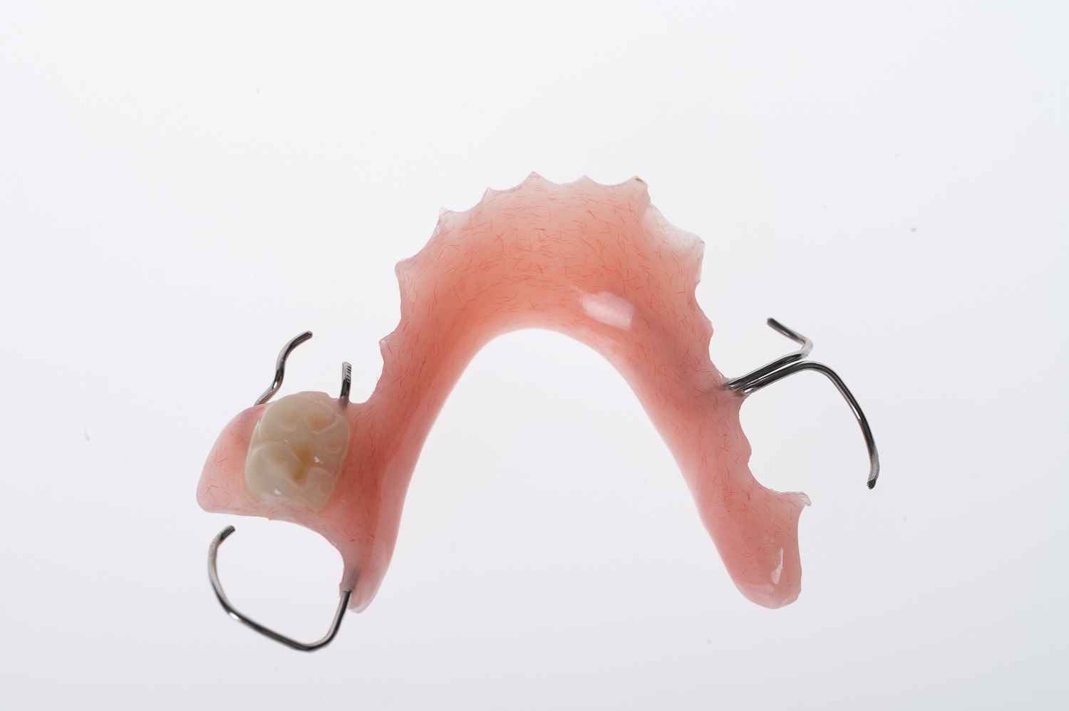 Acrylic Partial Dentures Affordable dental solutions